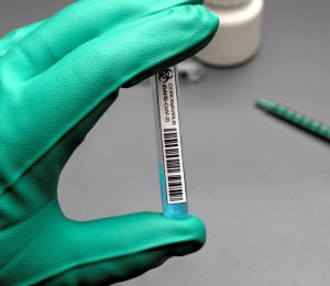 Retards en la logística de la vacunació contra la Covid-19